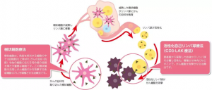 去日本看病了解细胞免疫疗法治疗过程